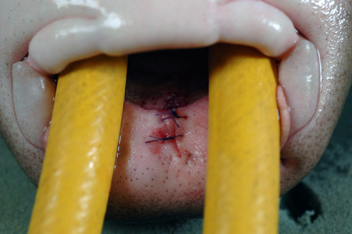 FOTO. Transformarea unui rechin uimeste lumea. Cum s-a schimbat dupa ce a fost aproape de moarte