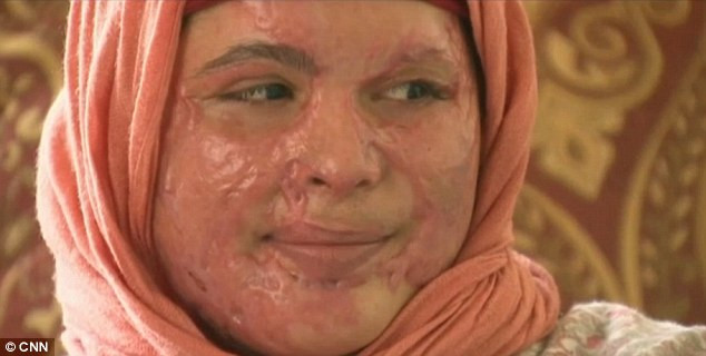 "Nu ma pot privi in oglinda". Drama unei femei din Afganistan care a refuzat sa se marite