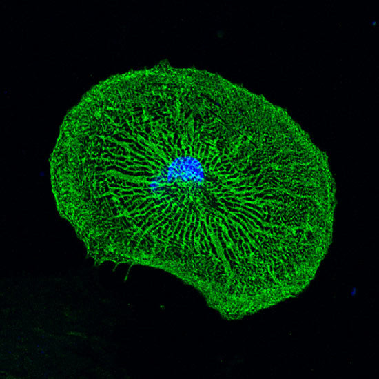 Savantii din Israel au descoperit in premiera mondiala cum pot fi tratate bolile de inima