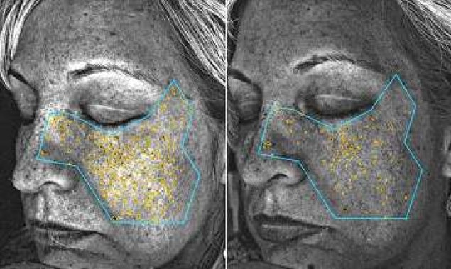 NASA a descoperit o bautura care ajuta la tratarea ridurilor si a petelor cauzate de soare