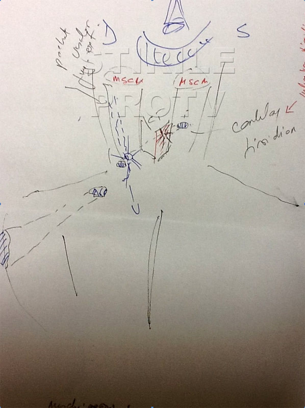 EXCLUSIV. Care a fost traiectoria glontului tras de Adrian Nastase. Schita facuta de unul din medici