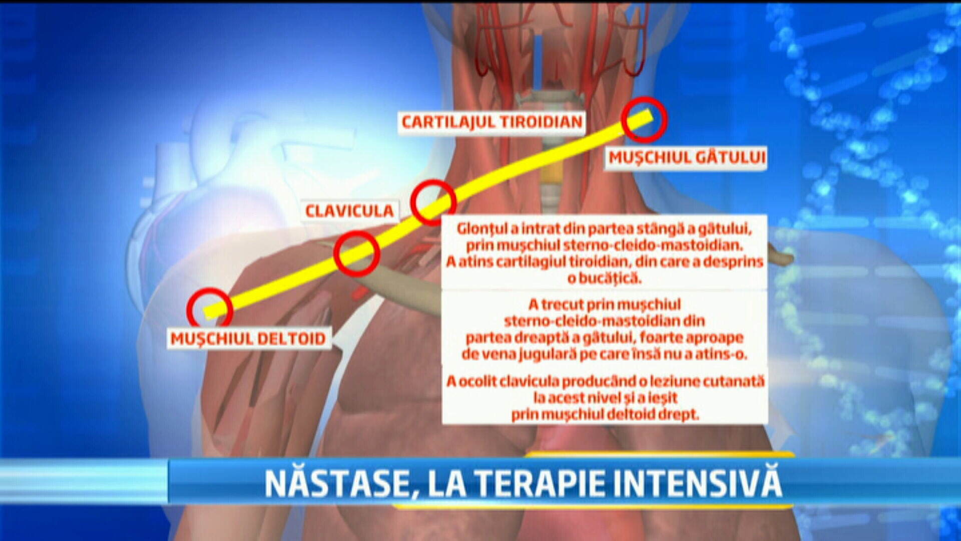 Cat de aproape a fost Adrian Nastase de moarte. Reconstituirea GRAFICA a traseului parcurs de glont