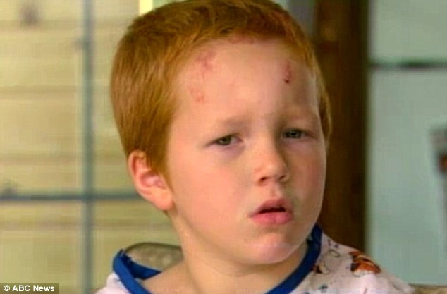 Acest copil nu trebuia sa fie in viata. "Era speriat de moarte. Nu se putea opri din zbierat". VIDEO