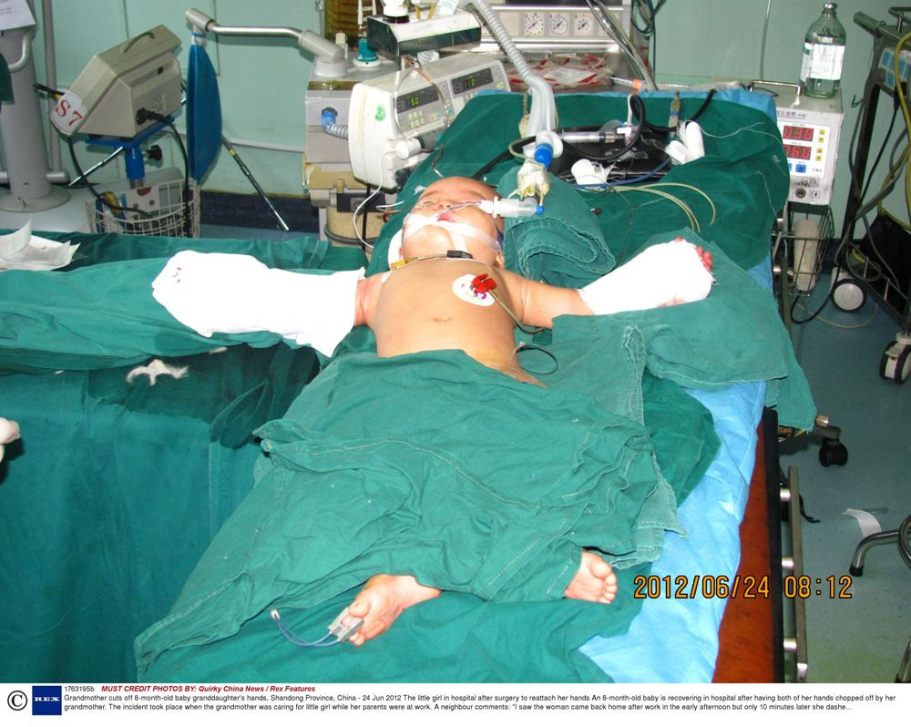 Caz socant in China. O bunica i-a taiat mainile nepoatei de 8 luni, apoi a incercat sa se sinucida