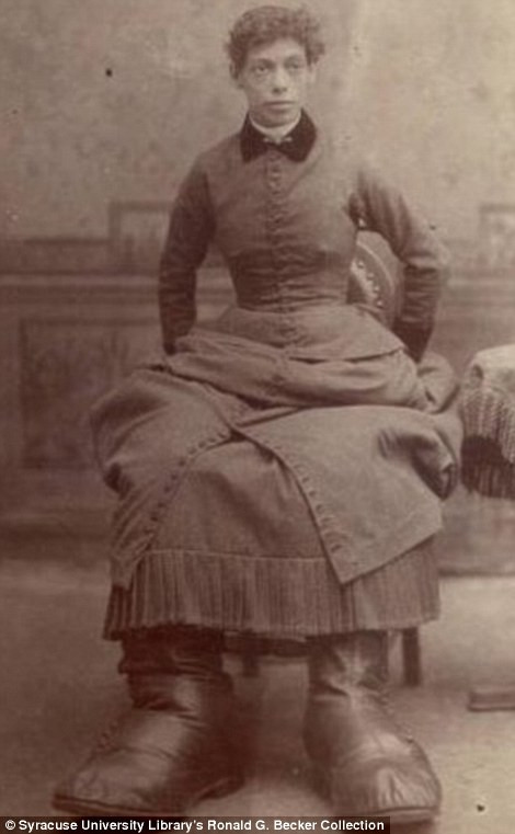 Fotografii impresionante cu membrii "Circului Ciudatilor", realizate in urma cu peste 150 de ani