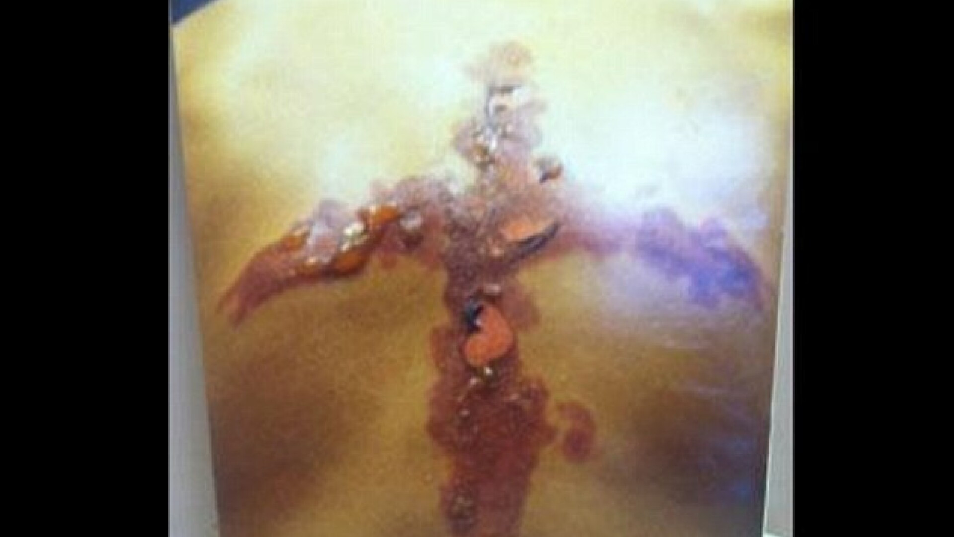 "De ce ar face cineva asa ceva?". Tot mai multi tineri se mutileaza, dupa o moda lansata pe internet