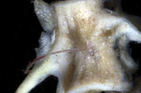 FOTO. Monstrul din adancuri care i-a uluit pe biologi. Viermele care poate dizolva oase de balena