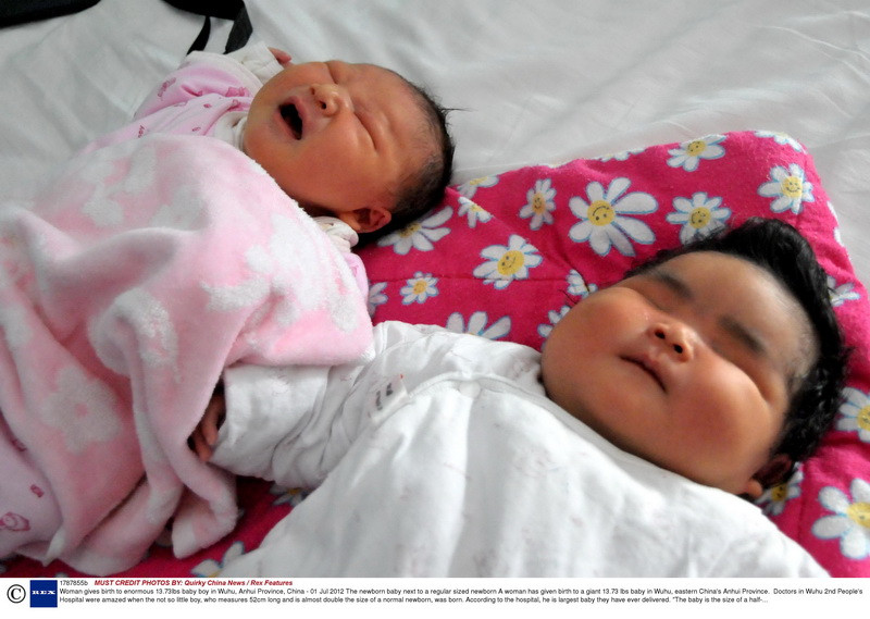 “Copilul acesta a stat 15 luni in pantecele mamei”. Medicii, uimiti de bebelusul adus pe lume