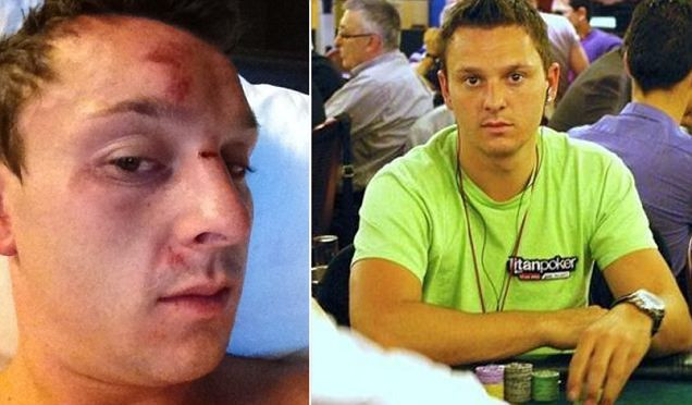FOTO: A fost MUTILAT pentru ca a avut curajul sa catige 10 milioane la poker. Cati bani a pierdut?