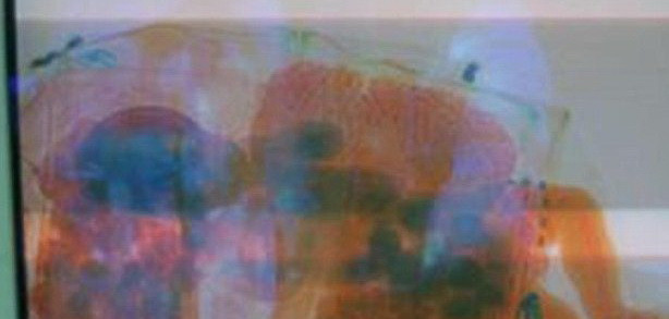 Gestul extrem al unor parinti. Si-au ascuns bebelusul de 5 luni intr-o geanta pentru a intra in tara