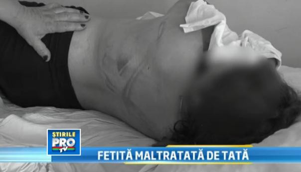 O fetita a fost batuta de tatal ei cu un furtun, pentru ca vorbise la telefon cu bunicul