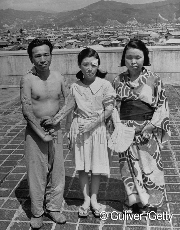 69 de ani de la lansarea primei bombe atomice din istorie, la Hiroshima. Ce ar trebui sa invete omenirea din aceste imagini