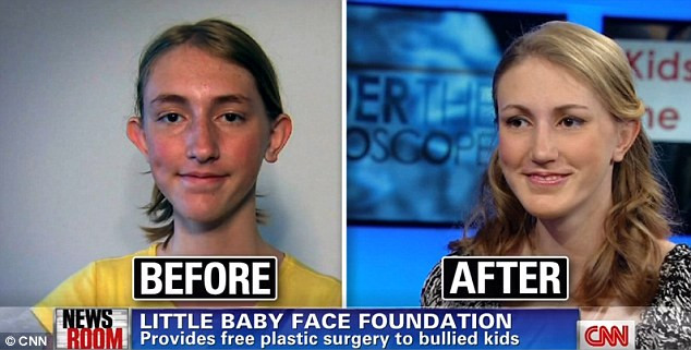 FOTO. Transformarea uluitoare a acestei fete, batjocorita pentru infatisarea ei. Vezi cum arata acum