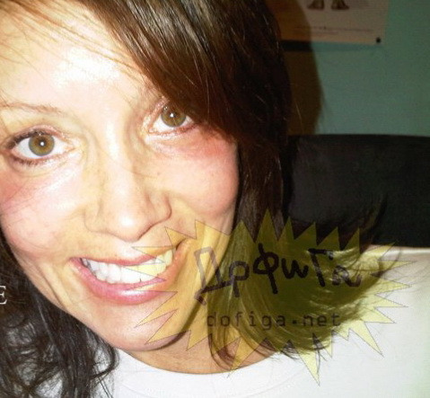 S-a uitat in oglinda si a vazut un monstru. Chinurile prin care a trecut pentru a arata bine. FOTO