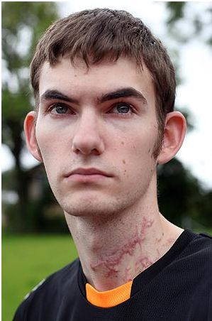 Un barbat a supravietuit in mod miraculos unui accident rutier dupa ce a fost aproape decapitat