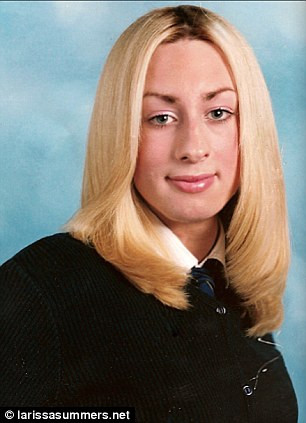 “Colegii ma strigau Pinochio si Dumbo”. Cum arata modelul inainte de operatiile de 80.000 de euro