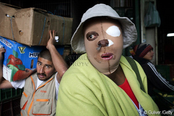 “Asta e pentru ca te crezi frumoasa".Sute de femei din Columbia sunt desfigurate cu acid, fara motiv