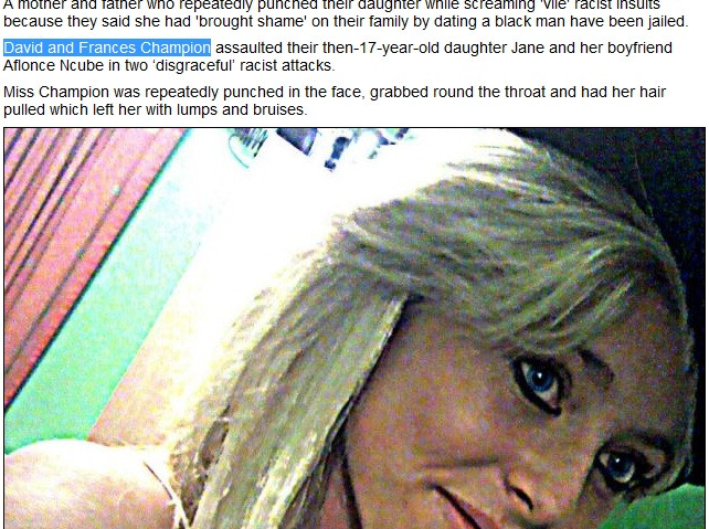 Umilita si desfigurata de parinti pentru a vrut sa fie fericita alaturi de un baiat de culoare