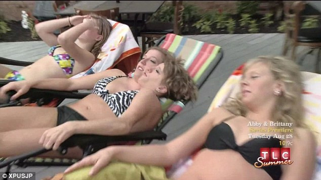 siamezele Abigail si Brittany Hensel 3