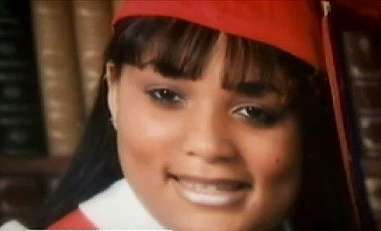 Doza cu steroizi administrata pentru o criza de astm a transformat-o pentru totdeauna. VIDEO