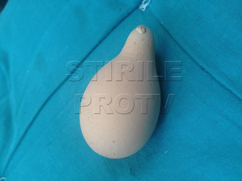 Descoperire ciudata facuta de o femeie din Romania in propria curte.A dat peste oul in forma de para