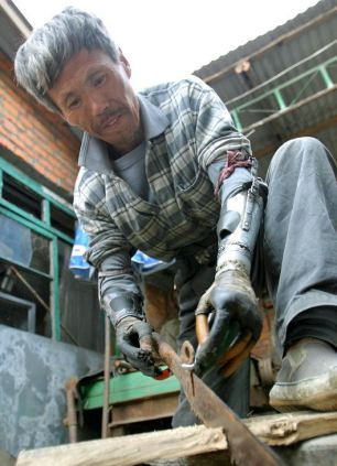 barbat cu maini bionice, proteze