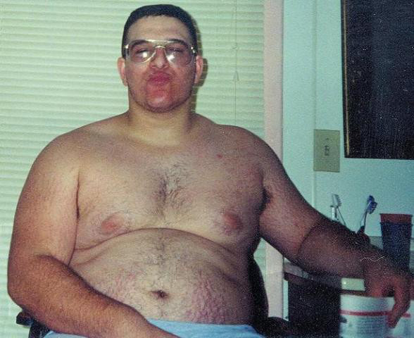 Acest barbat se afla intr-un scaun cu rotile. Cum i-a schimbat viata un accident grav. Galerie FOTO