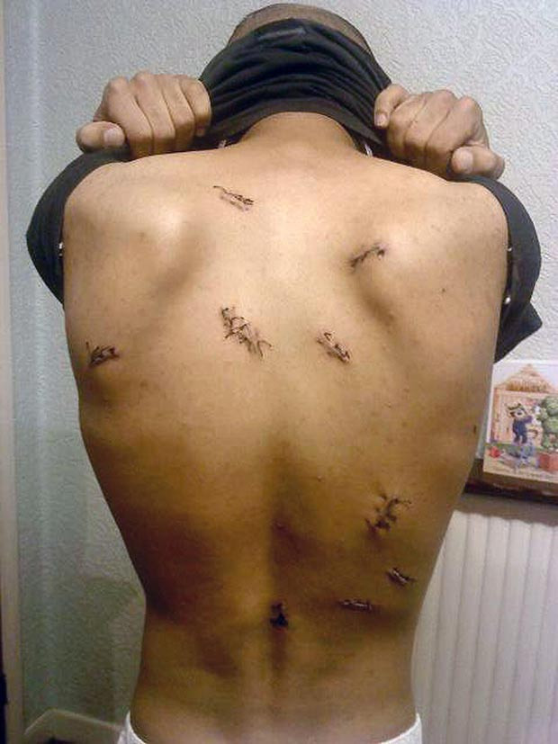 Nimeni nu isi traieste viata cum o face el. Un atac l-a transformat in prizonierul propriei minti