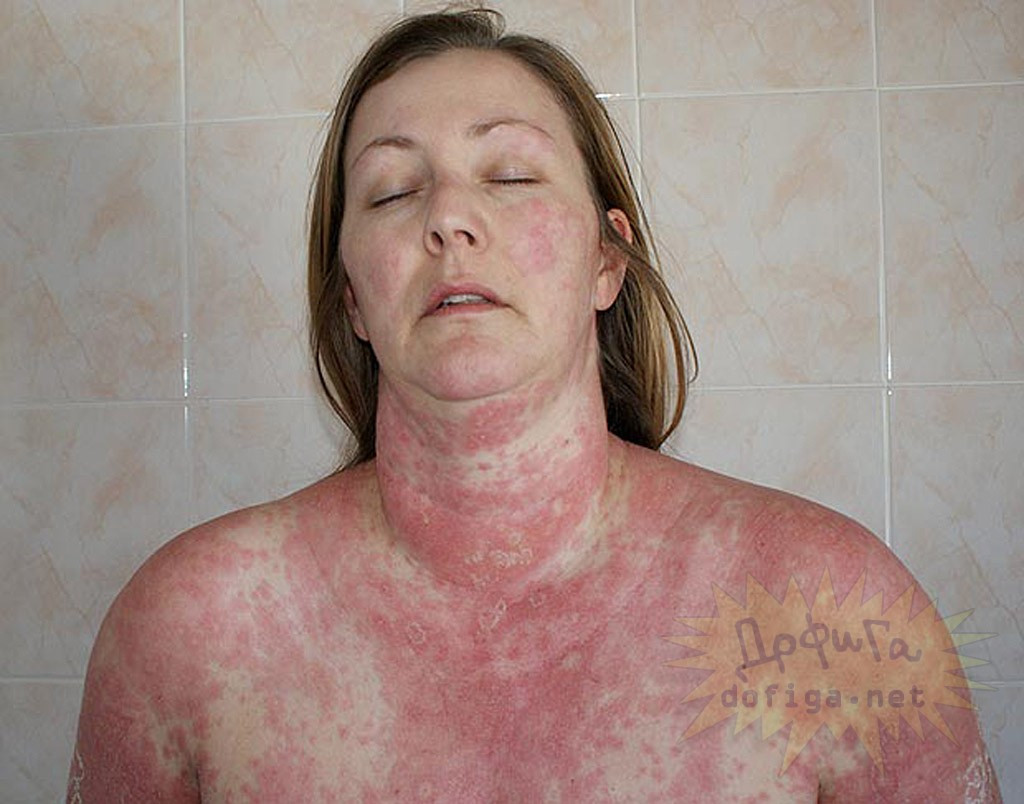 A crezut in recomandarile medicilor. Acum nu se mai poate uita in oglinda . GALERIE FOTO