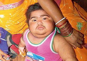 "Copilul nostru creste intr-un an cat altii in 20". Ce s-a intamplat peste noapte cu baiatul de 1 an