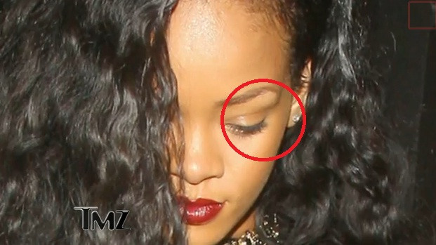 TMZ: Rihanna are un hematom deasupra ochiului stang. A fost batuta din nou de iubit? VIDEO