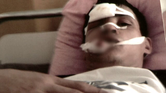 Ancheta la Spitalul Coltea: un pacient a intrat in operatie pentru sinuzita si a iesit fara 14 dinti