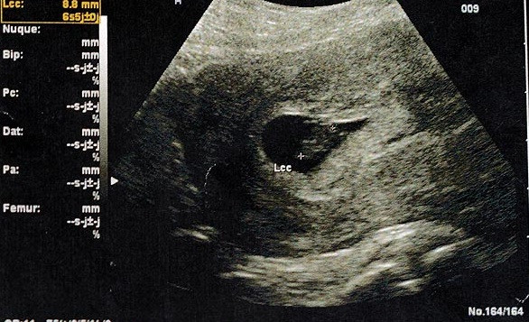 “Am avut 12 copii si i-am dat pe toti. Asa o sa fac si acum”. Motivul pentru care lumea o iubeste