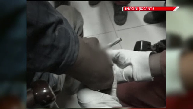 O brigada de pompieri s-a luptat sa il slaveze. Un dinte de fier de 6 centimetri putea sa-l mutileze