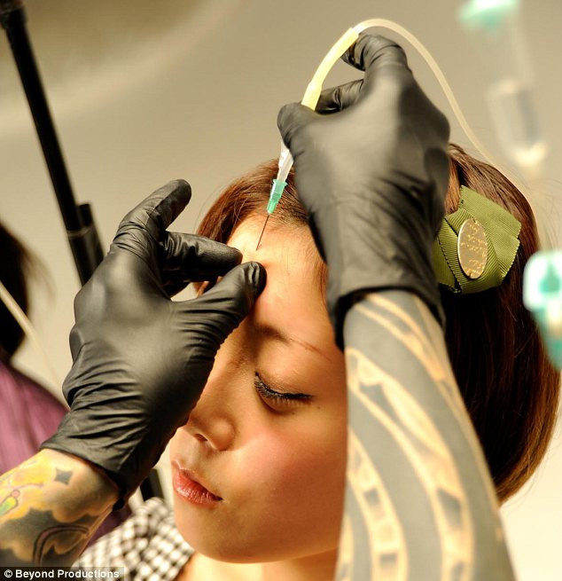 O tanara se expune unei proceduri extreme pentru a deveni mai "frumoasa". Ultima moda in tara ei