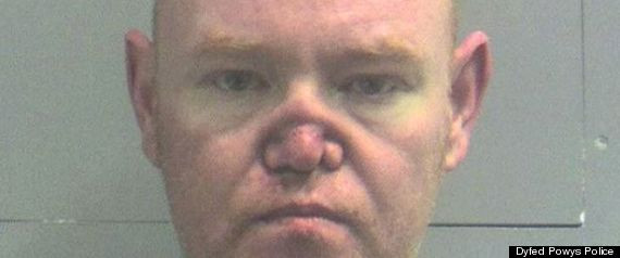 Drama unui milionar. Cum a ajuns sa arate din cauza consumului de cocaina. "I se topeste nasul"