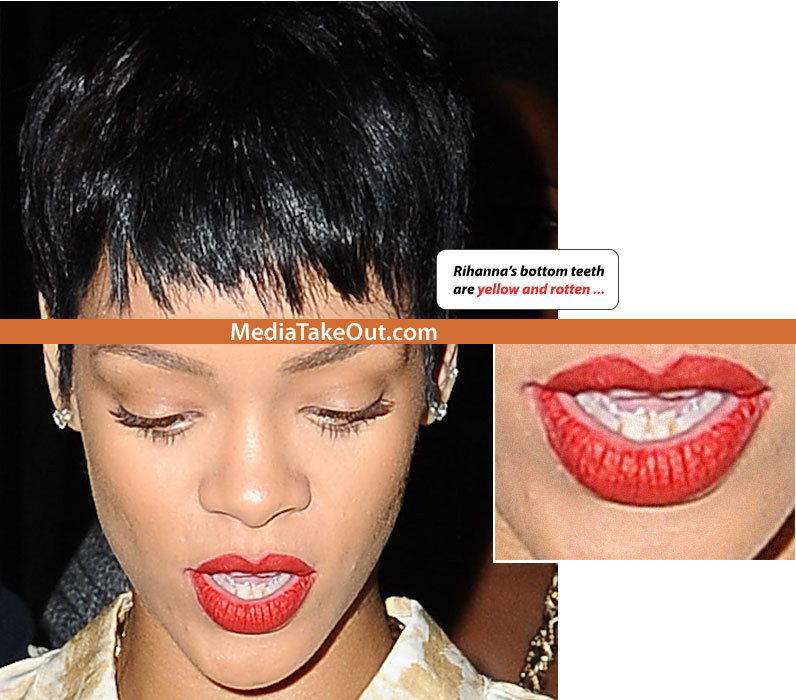 "Ramane fara dinti in gura de la consumul de marijuana". O vedeta, criticata de tabloide. FOTO