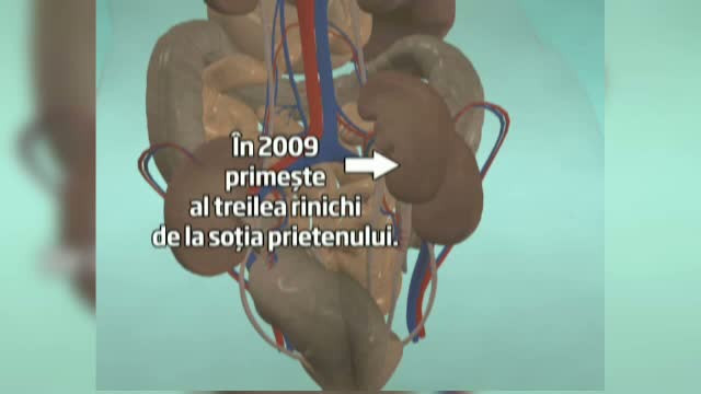 In ultimii 20 de ani, medicii de la Institutul de Urologie din Cluj au salvat 1.500 de vieti