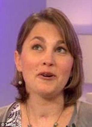 A invins moartea dupa un accident care a "decapitat-o intern". Medicii spun ca nu e un miracol. FOTO