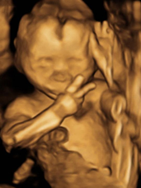 Semnul facut de un bebelus din pantecele mamei i-a lasat pana si pe medici muti de uimire. FOTO