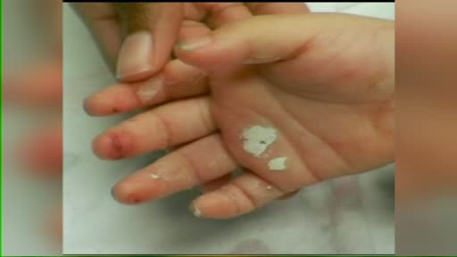 Poveste infioratoare in Statele Unite. Fetita de 5 ani, pedepsita intr-un mod sinistru de mama