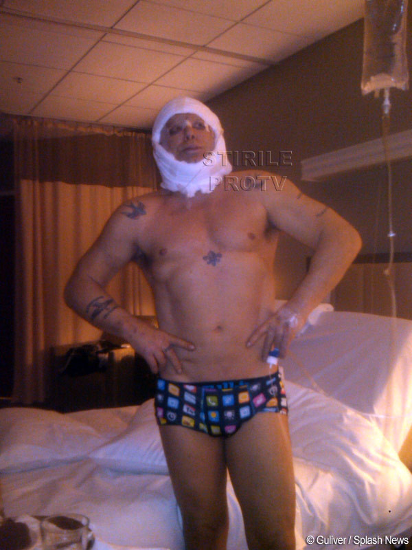 Cea mai penibila ipostaza in care putea sa apara acest actor. Pozele facute dupa operatia estetica