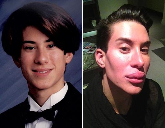 Justin Jedlica