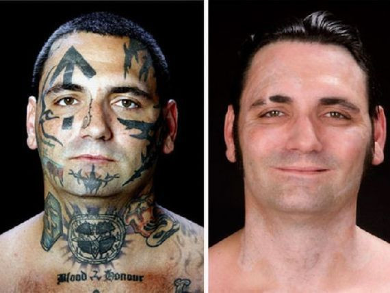 INAINTE si DUPA! Omul asta a suferit 25 de operatii pentru stergerea tatuajelor rasiste de pe corp! Vezi cati bani a scos din buzunar! VIDEO