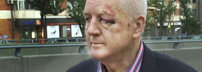 Jean Padureanu a fost ATACAT in fata blocului, in miezul zilei: "Am ramas acolo plin de sange"