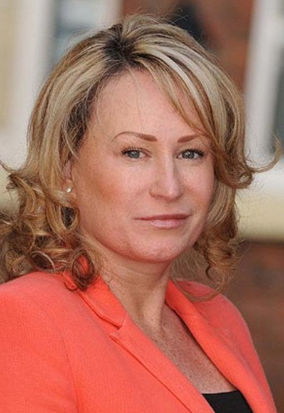 FOTO. Si-a dorit un ten perfect, insa tratamentului cosmetic folosit i-a distrus chipul. Cum arata