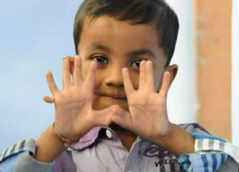 Povestea lui Arpan Saxena, copilul de 4 ani care are 25 de degete. Parintii: "nici gand sa-l operam"