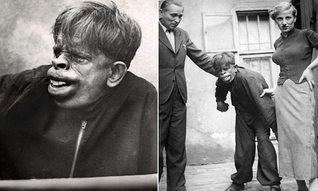 S-a aflat adevarul despe OMUL MAIMUTA dupa 75 de ani! FOTO SOCANT