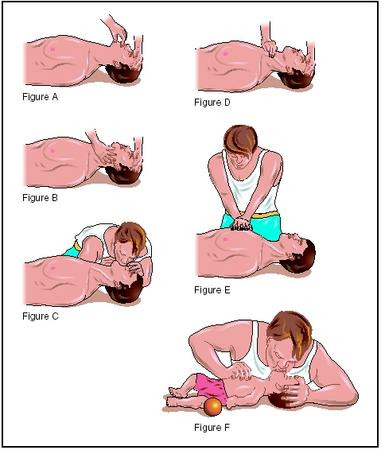 resuscitation