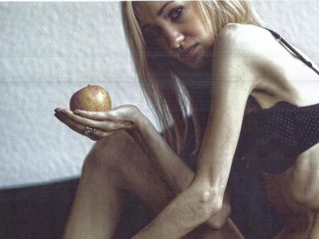 "Mi-a luat tot. Prietenii, frumusetea, viata". Cum a ajuns ca la 19 ani sa aiba doar 29 de kilograme